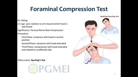 cervical quadrant compression test|lhermitte's sign vs spurling test.